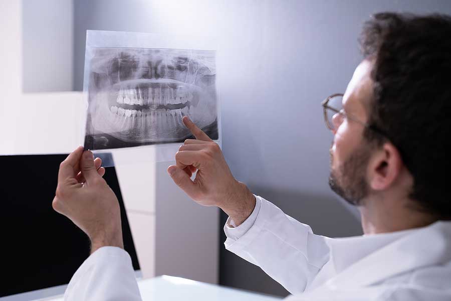 Dental professional looking at an x-ray of a set of teeth and pointing to a wisdom tooth.